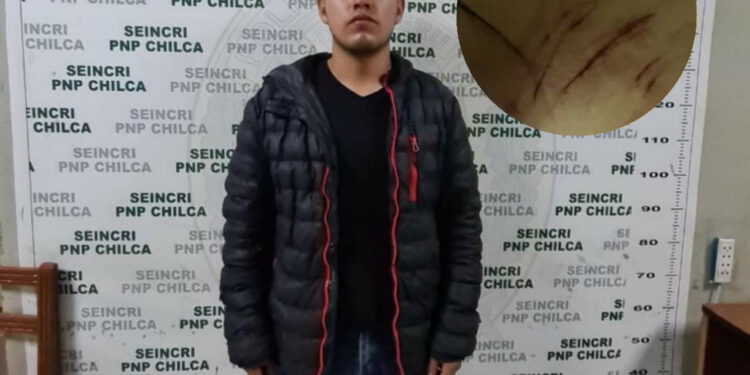 Chilca: Con un cuchillo de cocina joven intentó asesinar a su ex pareja