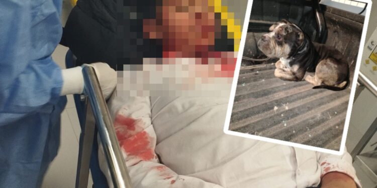 Perro pitbull ataca y deja graves heridas en el rostro a menor de 11 años