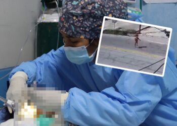 Niña atropellada en La Merced permanece en UCI del Hospital El Carmen y requiere más evaluaciones especializadas