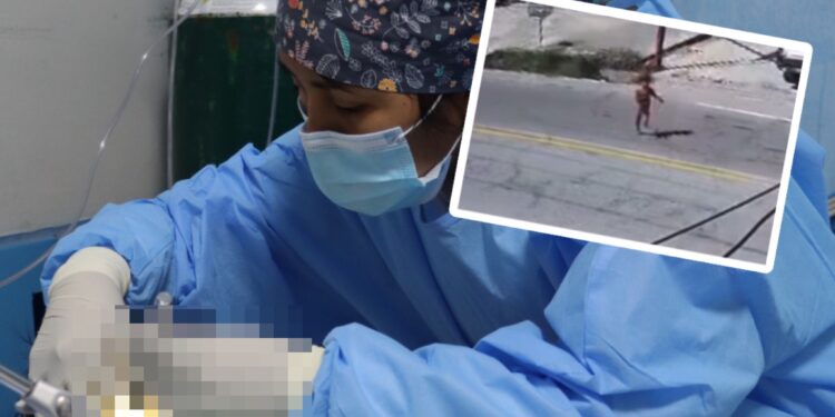 Niña atropellada en La Merced permanece en UCI del Hospital El Carmen y requiere más evaluaciones especializadas
